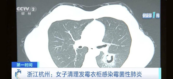墻面發(fā)霉致癌？電滲脈沖技術(shù)‘抽干’墻體水分，30年不發(fā)霉